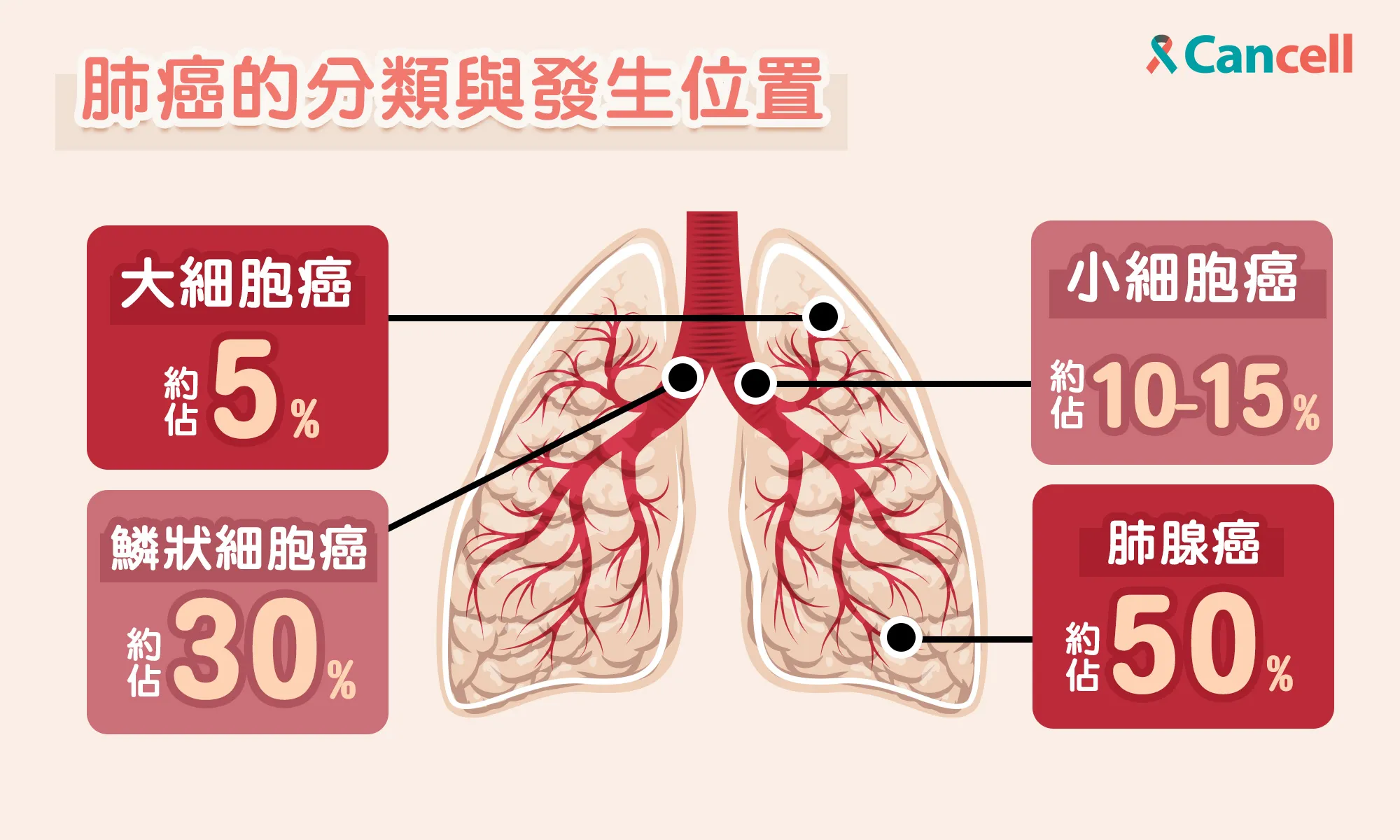 非小細胞肺癌