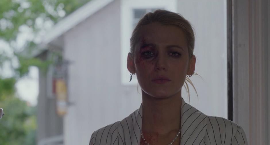 Emily opens the door of the police station with a black eye.