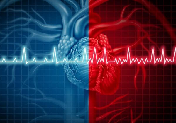 Atrial Fibrillation Symptoms - Cardiovascular Diseases - 1MD