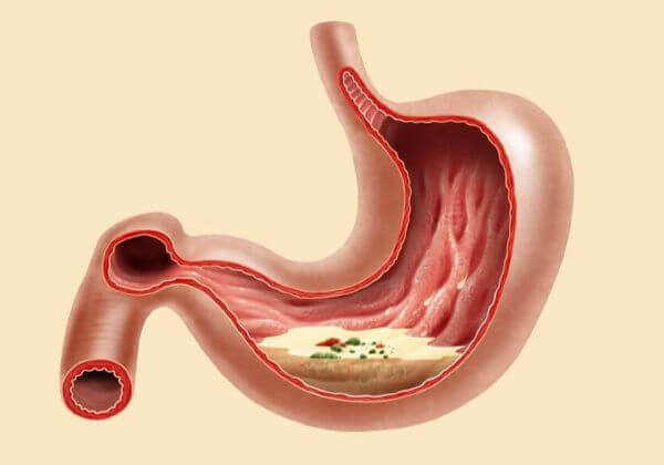 Low Stomach Acid Symptoms - Digestion - 1MD