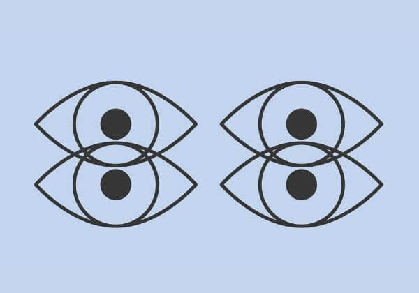 Double Vision (Diplopia): Symptoms, Associated Conditions, and Treatment