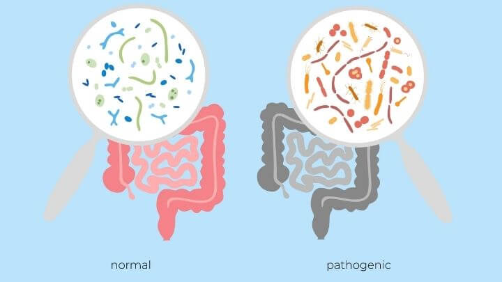 Gut bacteria balance