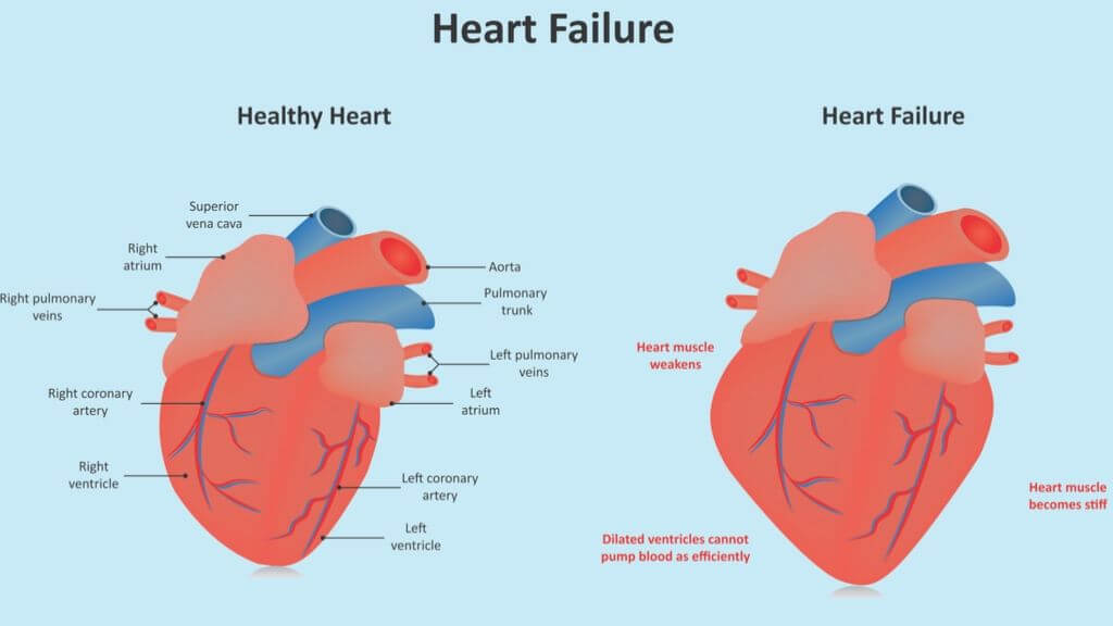 differences between two sides of heart