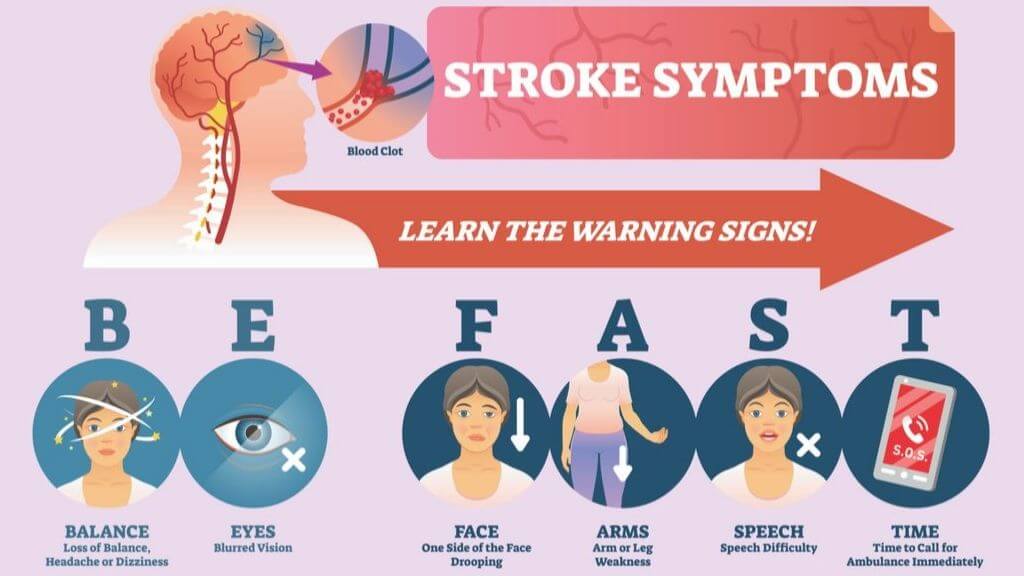 Stroke: Types, Symptoms, and Long-Term Outlook | 1MD Nutrition™
