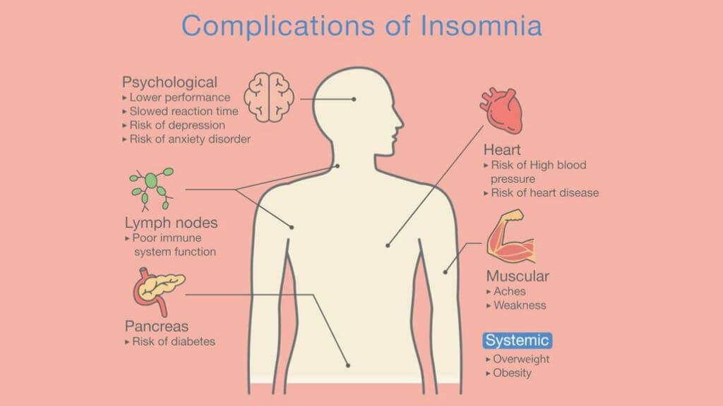 signs of insomnia test