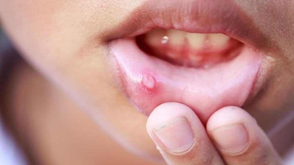 close-up of a person's mouth