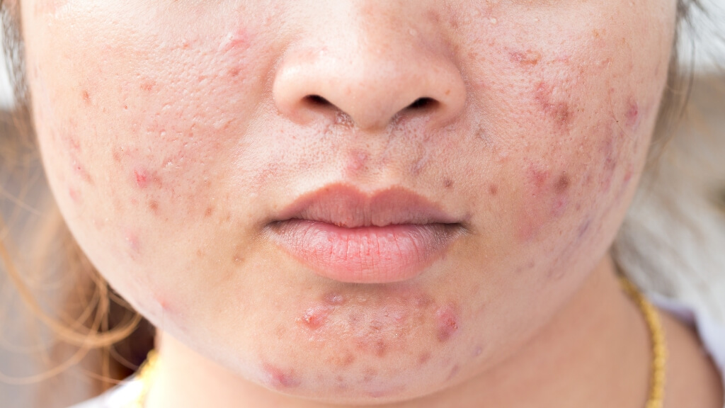 a close up of a person's face