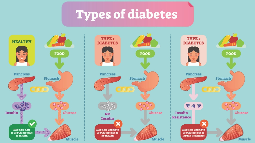 what is diabetes