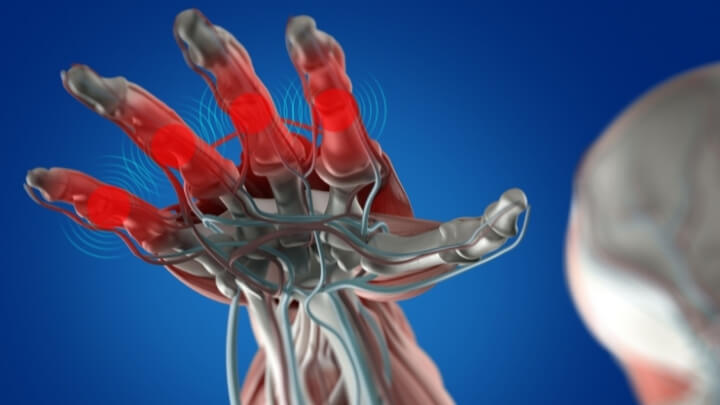 Joint health concept illustration