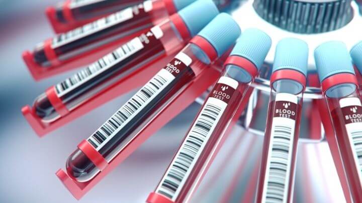 Lab equipment centrifuging blood