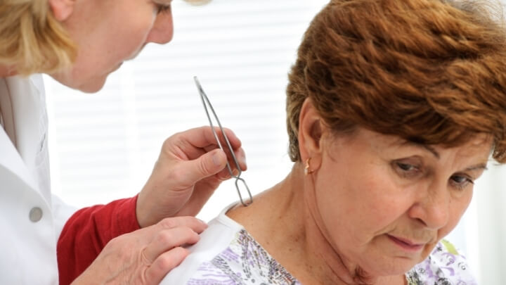 A doctor removing a tick from a woman's back