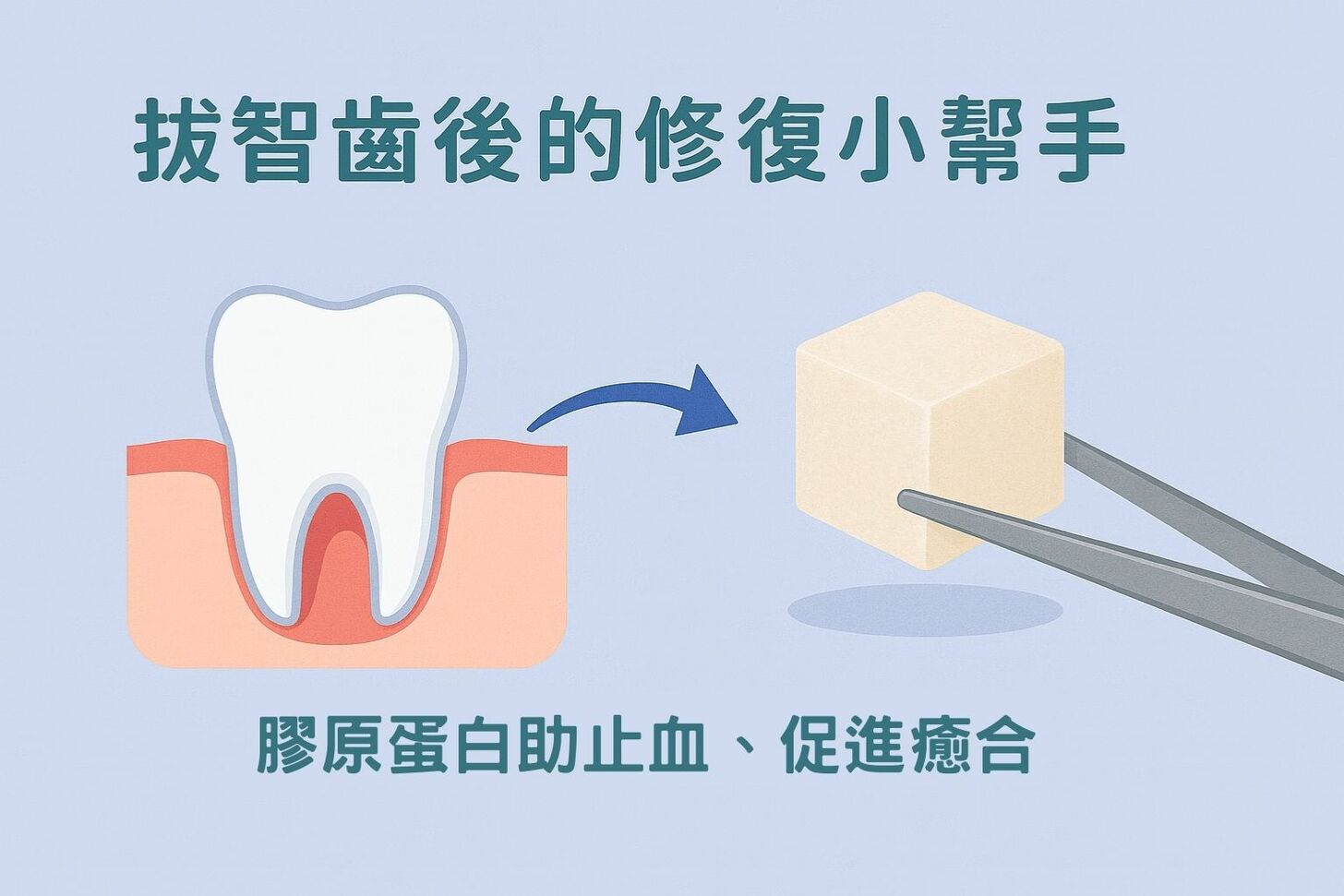拔智齒後放膠原蛋白有必要嗎?費用、效果、恢復期一次看懂 拔智齒後放膠原蛋白