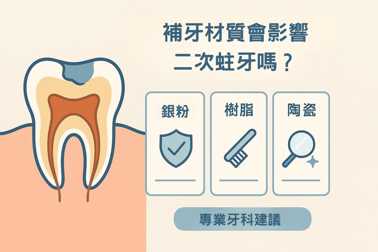 補牙後又蛀牙?了解二次蛀牙的原因與預防方法 補牙材質會影響二次蛀牙機率嗎?