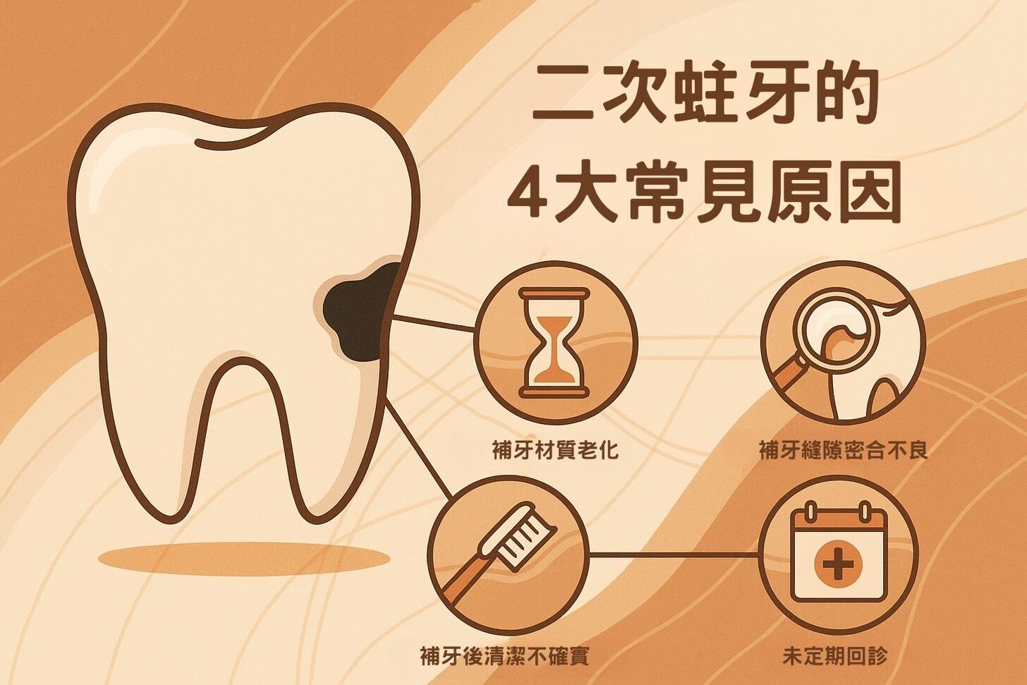 補牙後又蛀牙?了解二次蛀牙的原因與預防方法 二次蛀牙的 4 大常見原因