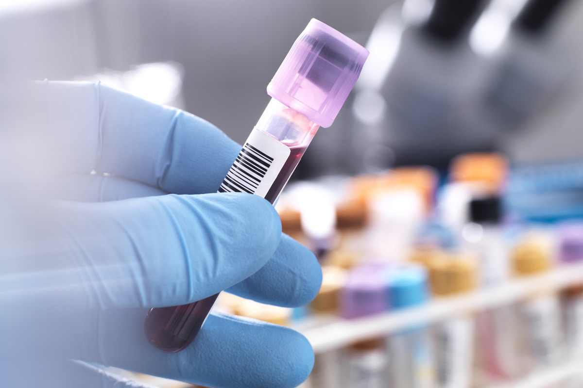 Blood Transfusion for Anemia: Reasons It Is Performed