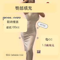 韓國臀部填充價格：每cc 15,000 韓元，最低100cc