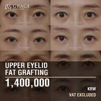 Upper Eyelid Fat Grafting Cost in Korea: 1,400,000 KRW