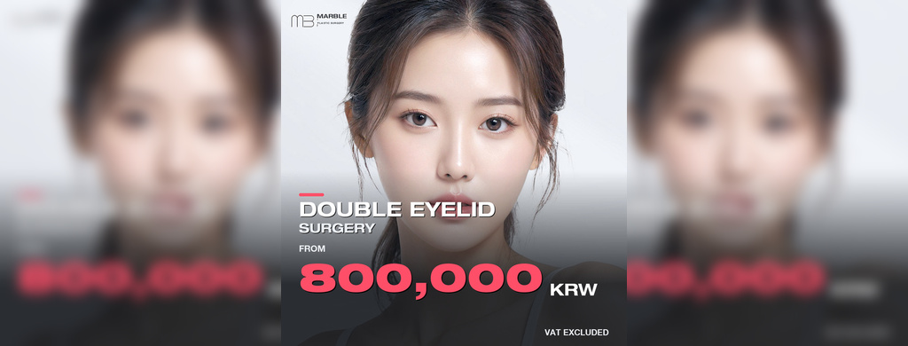Double Eyelid Surgery Cost in Korea: 800K KRW Deal