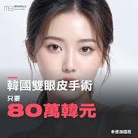 韓國雙眼皮手術費用：80萬韓元優惠