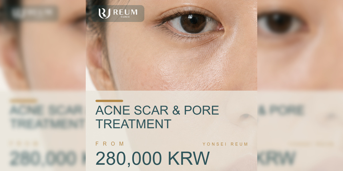 Acne Scar & Pore Treatment Cost in Korea: Packages from 280,000 KRW