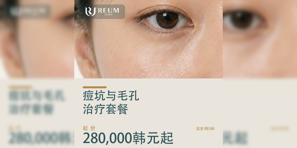 韩国痘坑与毛孔治疗价格：四档套餐280,000韩元起