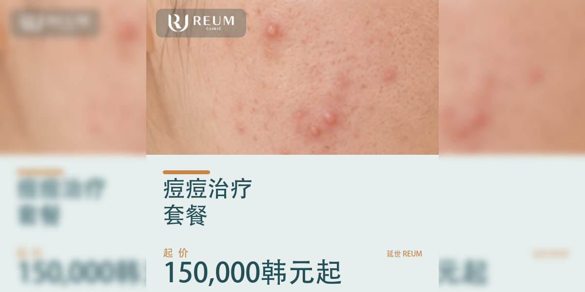 韩国痘痘治疗价格：三档套餐150,000韩元起