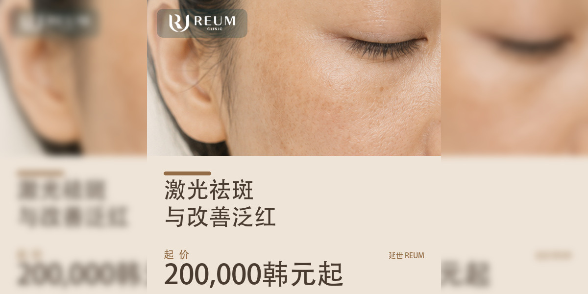 韩国激光祛斑与改善泛红价格：三档套餐200,000韩元起