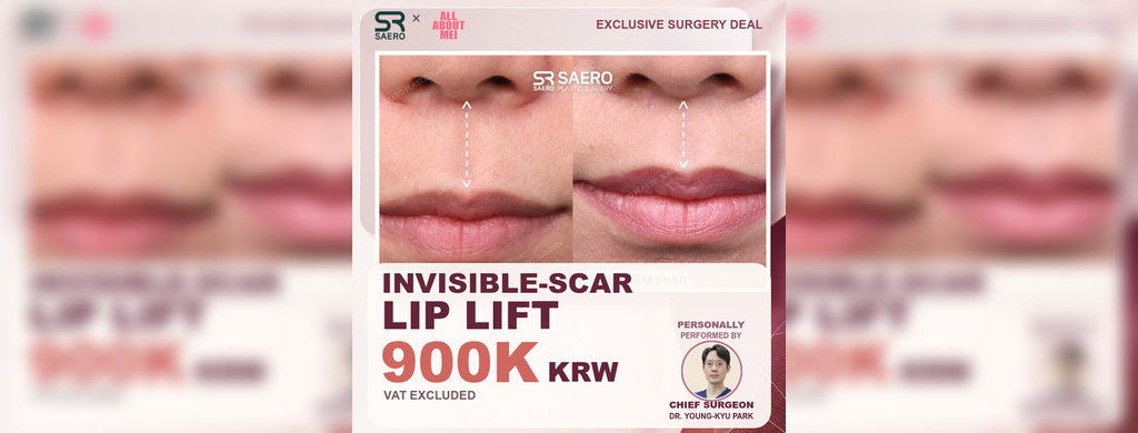 Invisible-Scar Lip Lift Cost: 900K KRW