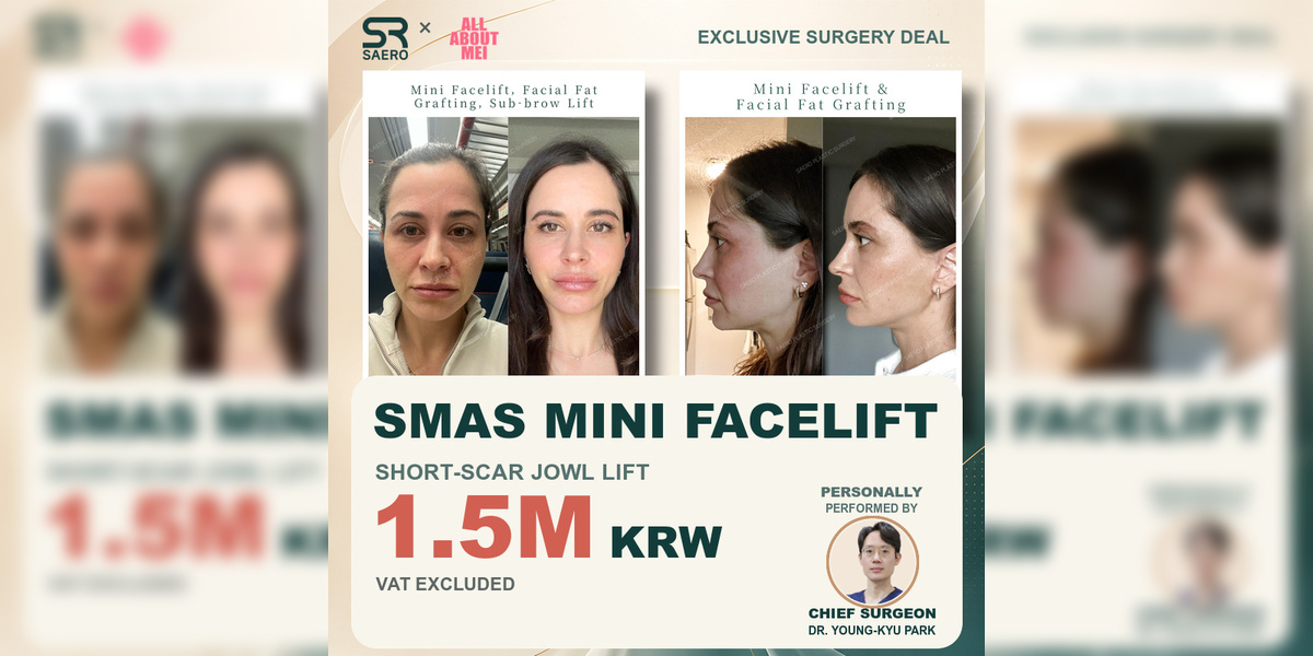 SMAS Mini Facelift Cost: 1.5M KRW Short-Scar Jowl Lift