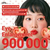 Lateral & Lower Canthoplasty Price and Patient Reviews in Korea: 900K KRW