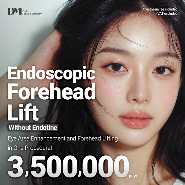 Endoscopic Forehead Lift Cost in Korea: 3.5M KRW without Endotine