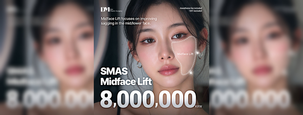 SMAS Midface Lift: Surgery, Recovery & 8M KRW Price