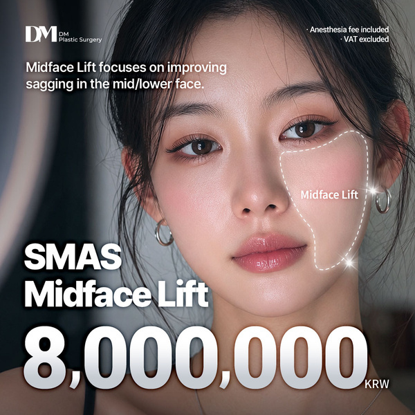 SMAS Midface Lift: Surgery, Recovery & 8M KRW Price