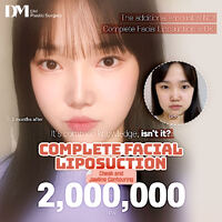 Face Liposuction Cost in Korea: Cheeks & Jawline 2M KRW