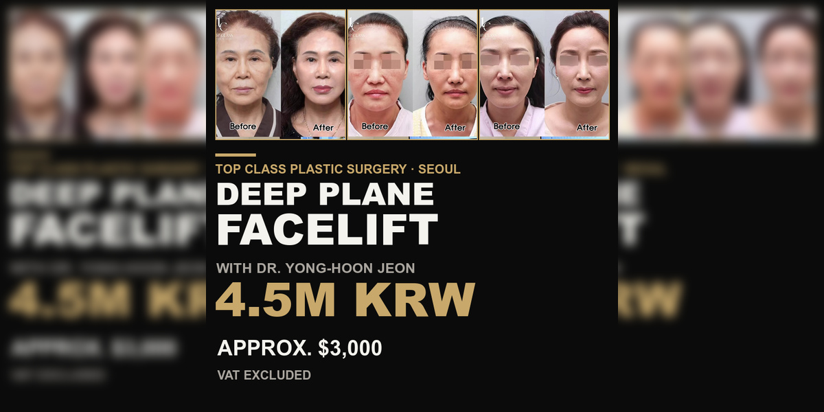 Deep Plane Facelift Cost in Korea: 4.5M KRW (Approx. $3,000)