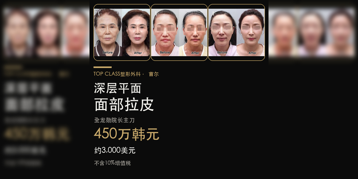 韩国深层平面拉皮手术价格：450万韩元（约3,000美元）