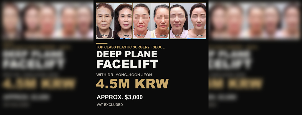 Deep Plane Facelift Cost in Korea: 4.5M KRW (Approx. $3,000)