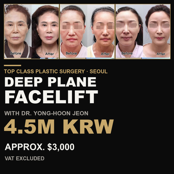 TOP CLASS deep plane facelift 4.5M KRW promotion thumbnail