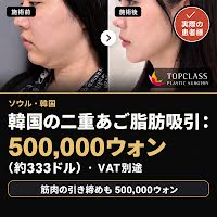 韓国の二重あご脂肪吸引：500,000ウォン（約333ドル）