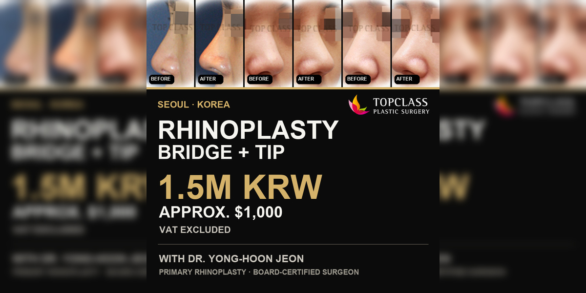 Rhinoplasty Cost in Korea: Bridge + Tip for 1.5M KRW ($1,000)
