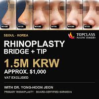 Rhinoplasty Cost in Korea: Bridge + Tip for 1.5M KRW ($1,000)