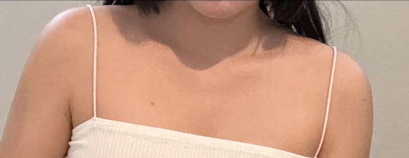 Armpit mini liposuction TALKS review thumbnail