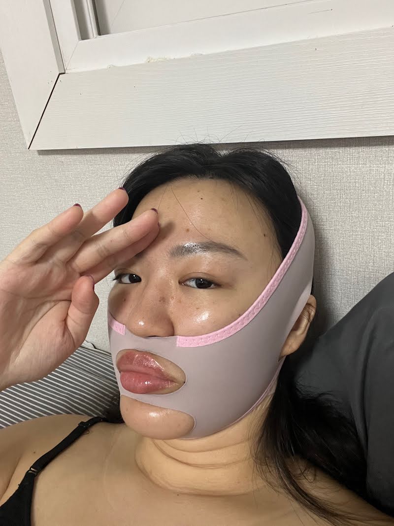 Face and body liposuction TALKS review thumbnail