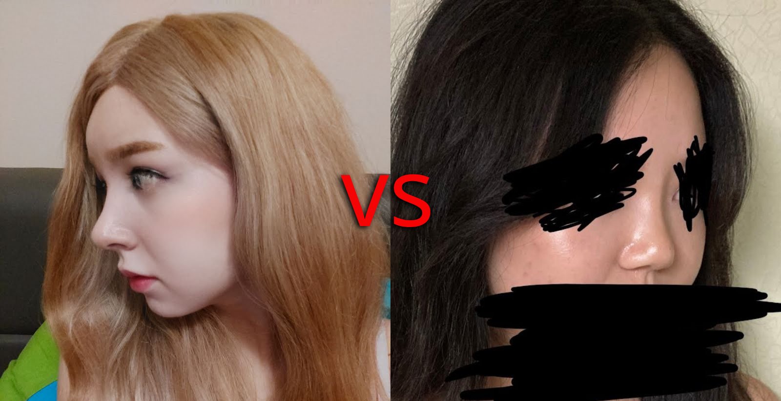 Compare the styles of rhinoplasty at NANA hospital thumbnail