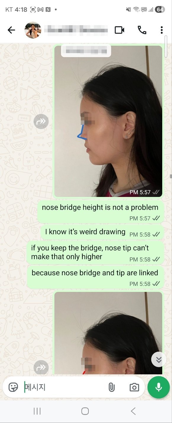 Consultation photo showing tip only change explanation