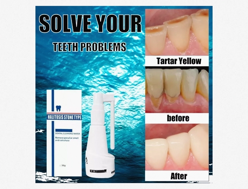 Dental Calculus Dissolving Spray Tartar Remover Teeth Cleaner Mouth and Teeth Care