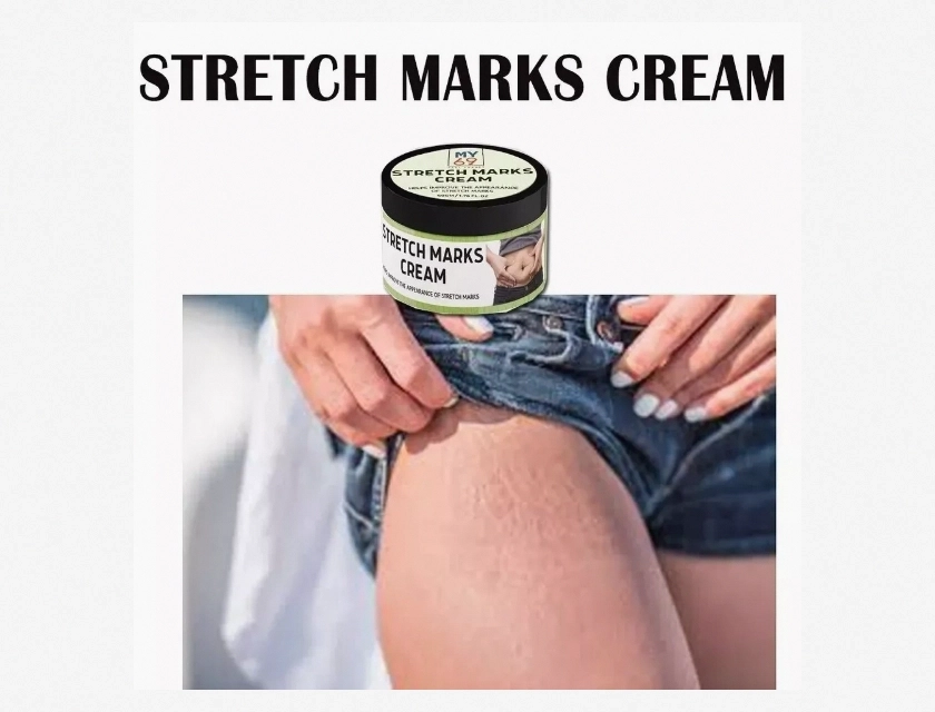 Scar Removal Cream for Surgery, Acne, and Stretch Marks – Advanced Formula for Smooth Skin