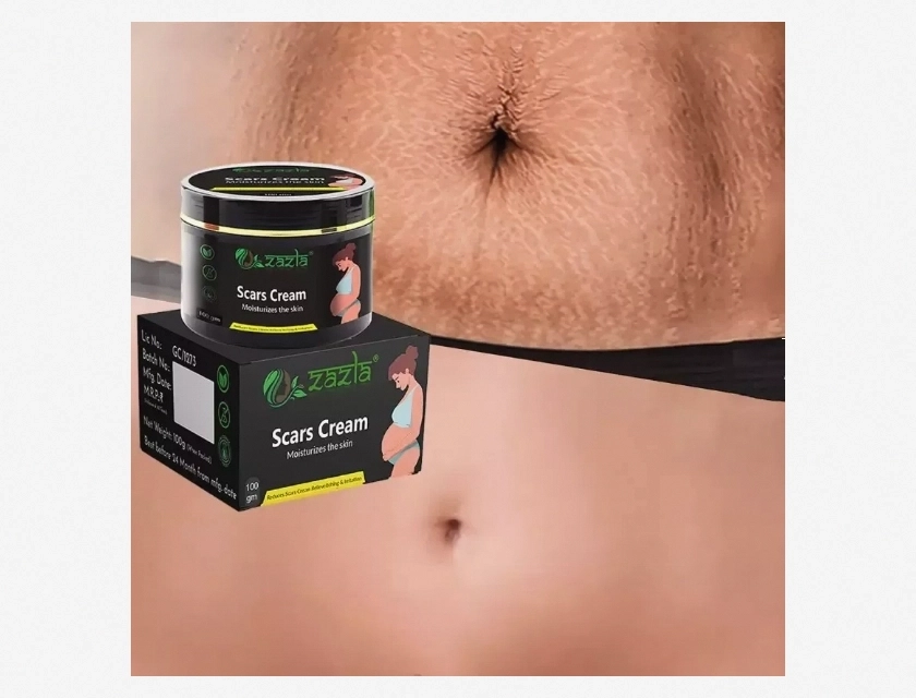 Anti Stretch Mark Cream Moisturizing and Preventing 100g
