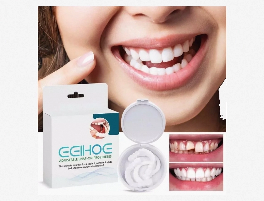 Adjustable Instant Smile Veneer Denture Teeth Set for Whitening and Comfort Fit