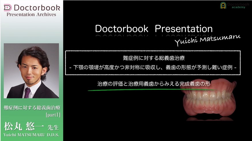 人気動画】総義歯難症例を成功させる3つのステップ | Doctorbook 